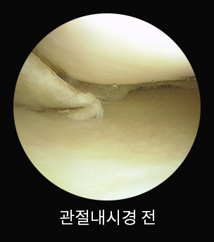 수술 전