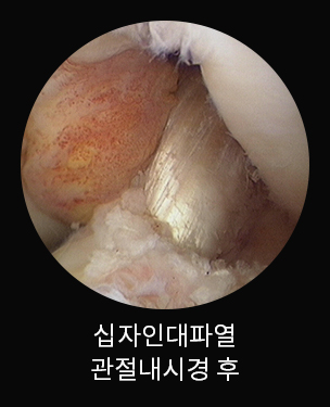 수술 전