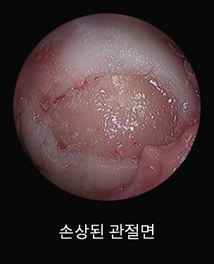 수술 전